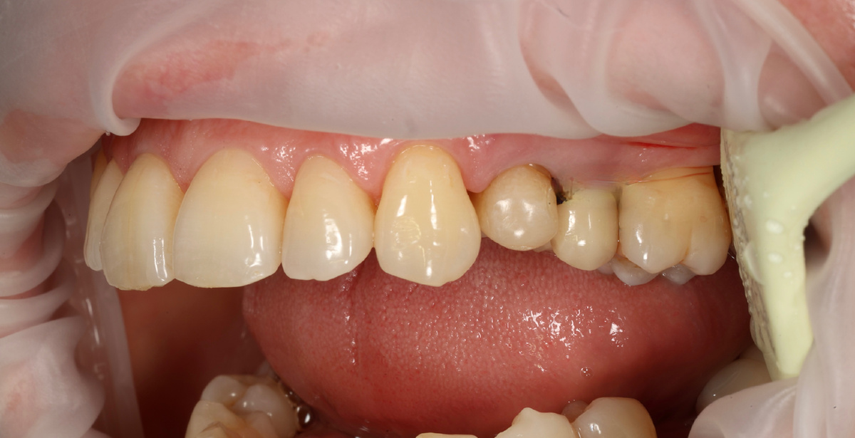 Для обложки - не шокирующий контент