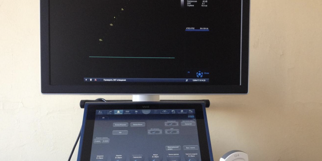 Размер атеросклеротической бляшки: когда врачи назначают лечение