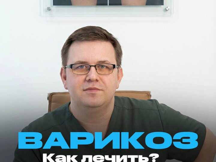 📎ВАРИКОЗ и что с ним делать