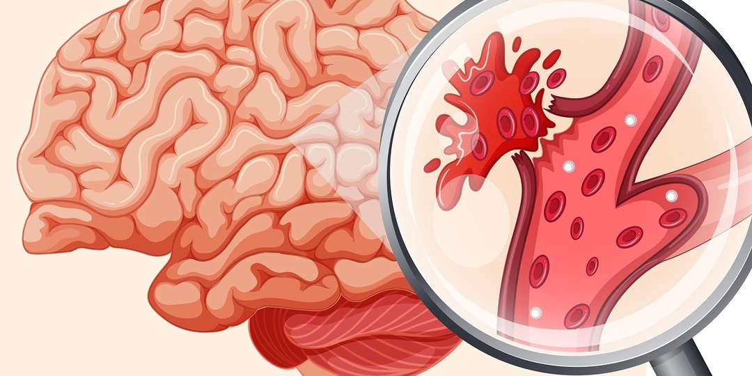 Этот Сигнал Мозга Может Появляться Без Явных Причин