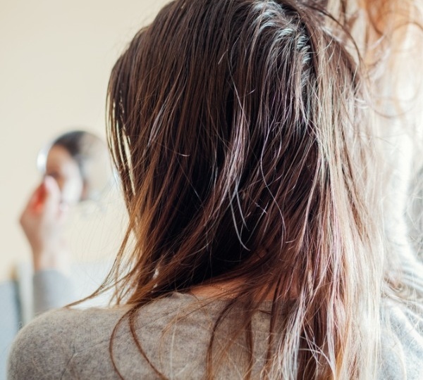 Волосы будто грязные: почему уход и укладка могут вредить здоровью кожи головы