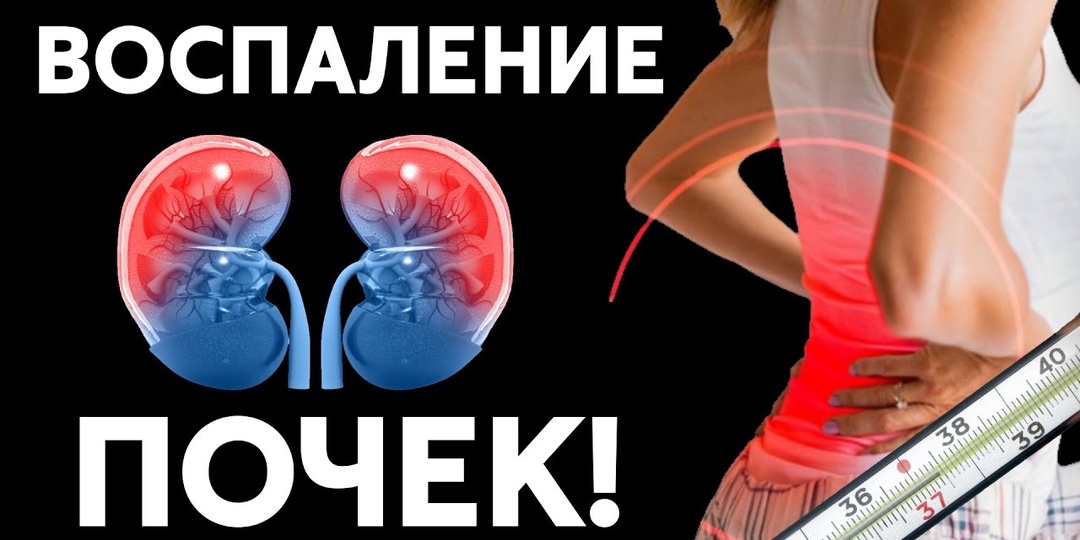 Симптомы пиелонефрита у женщин: признаки воспаления почек