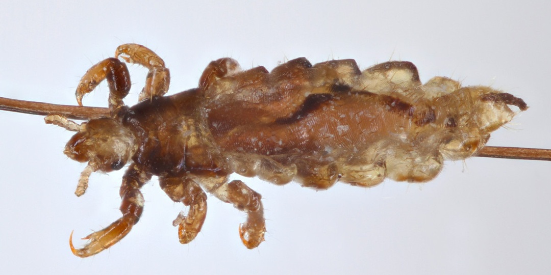 Самая крупная вошь в мире: кто этот гигант среди паразитов и почему он такой большой