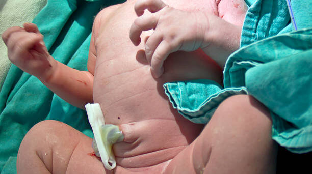 Сразу после рождения