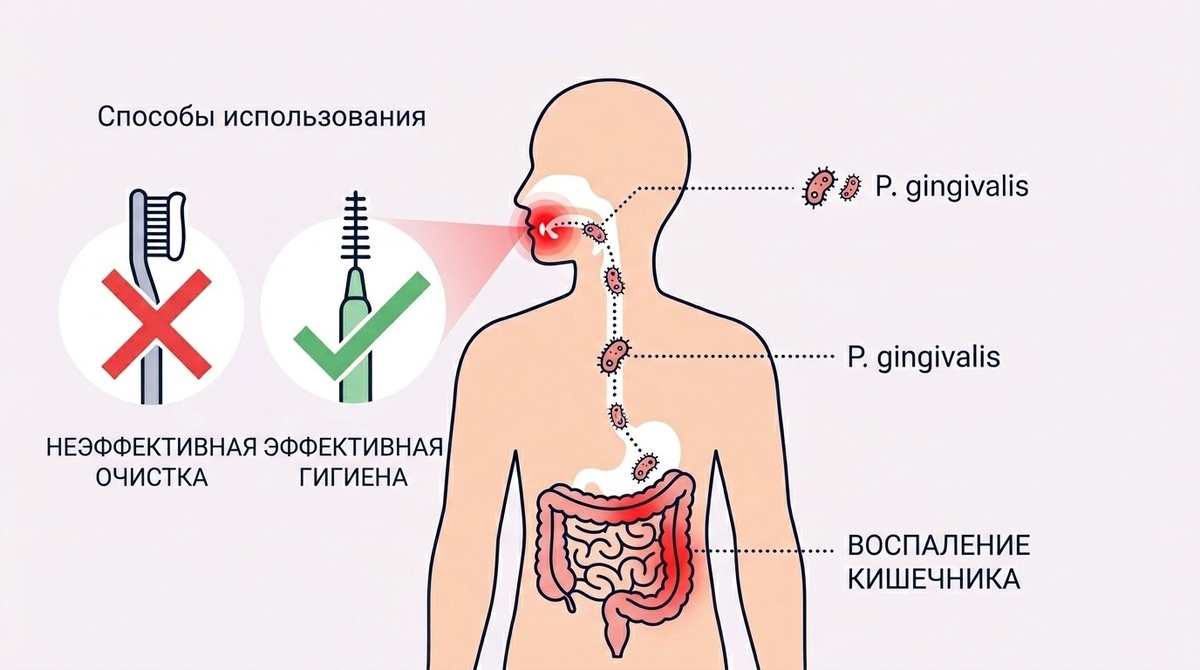Попадая в кишечник, гиингипаины работают по той же схеме