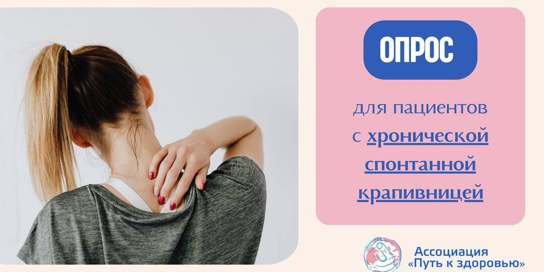 Новый препарат для лечения крапивницы - да или нет?