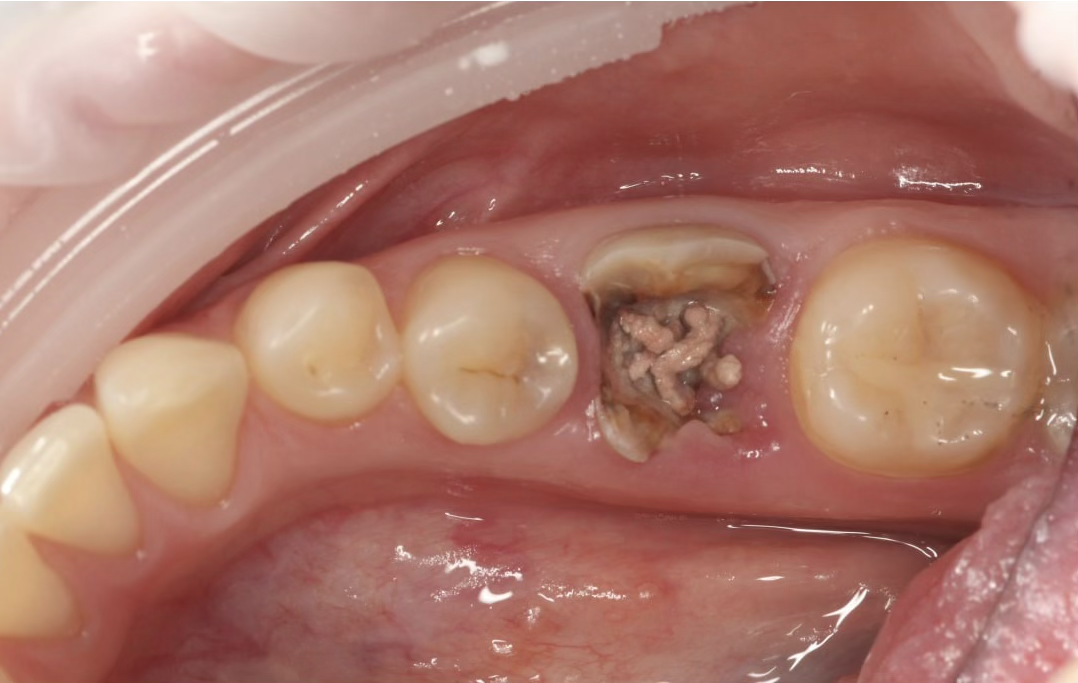 Ситуация до