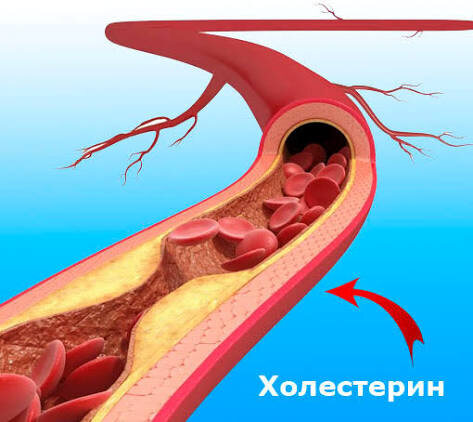 Холестерин: жизненно необходимый элемент и фактор риска — что нужно знать