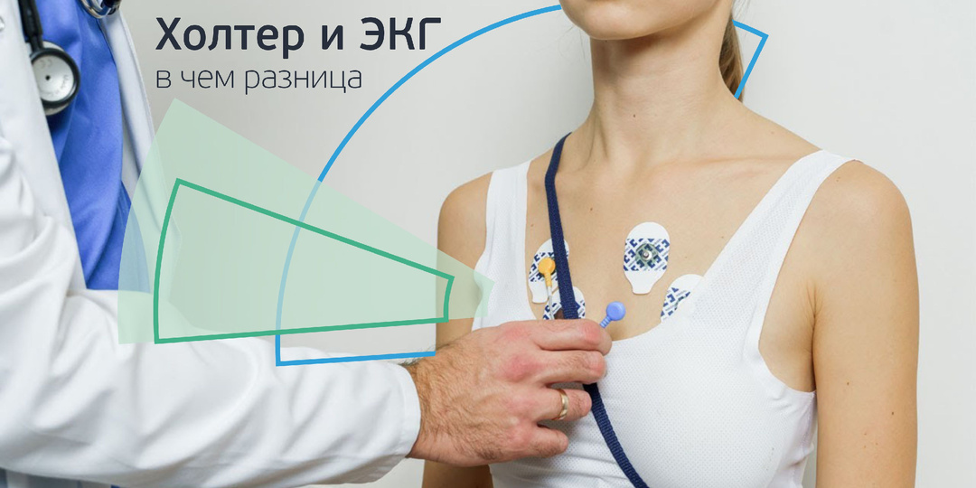 Холтер и ЭКГ. О чем говорят и как подготовиться
