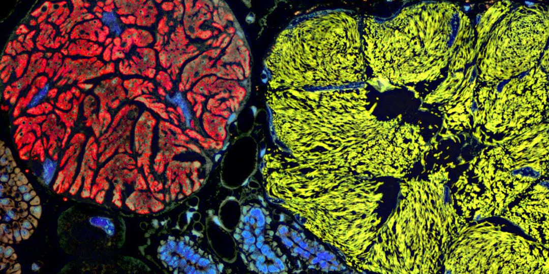 Микроб с самым маленьким геномом стирает границы жизни