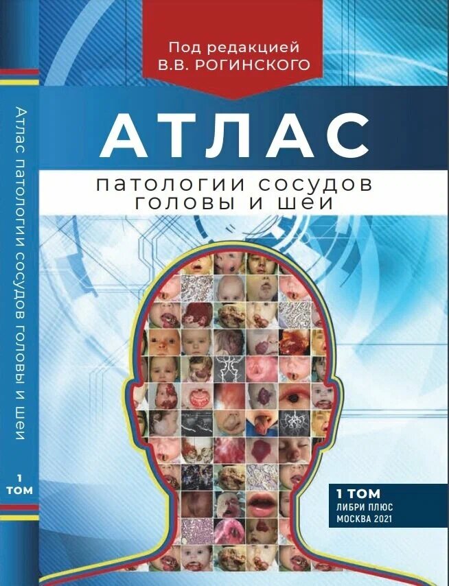 Атлас патологии сосудов головы и шеи. Рогинский В.В.
