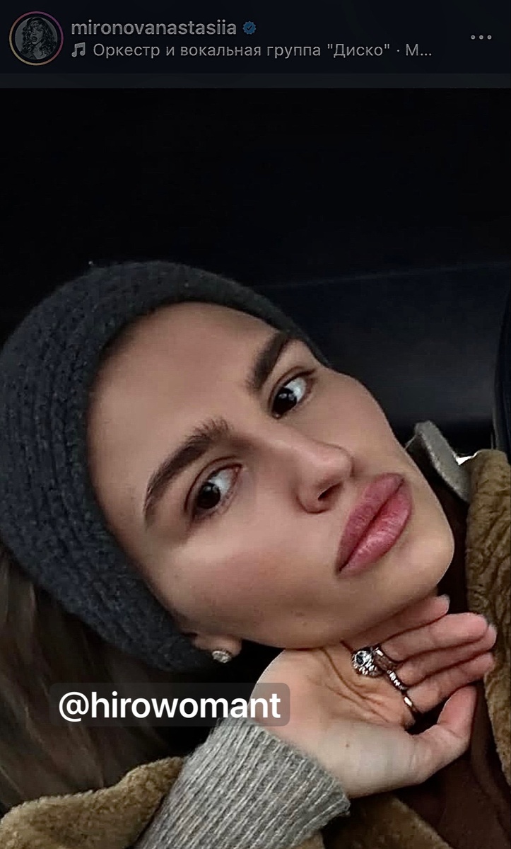 Разворот ладони Анастасии Мироновой. 