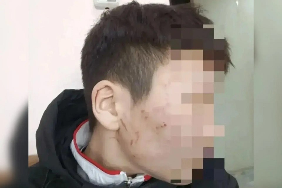    13-летний мальчик из Тувы рассказал об истязании собственной матерью. Фото: 108 канал