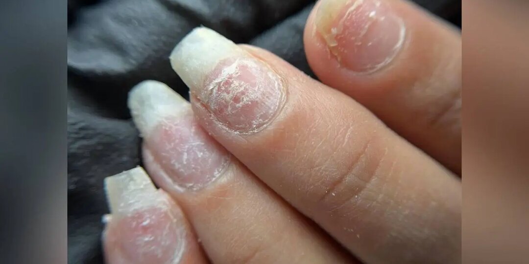 Как работать с тонкими и ослабленными ногтями