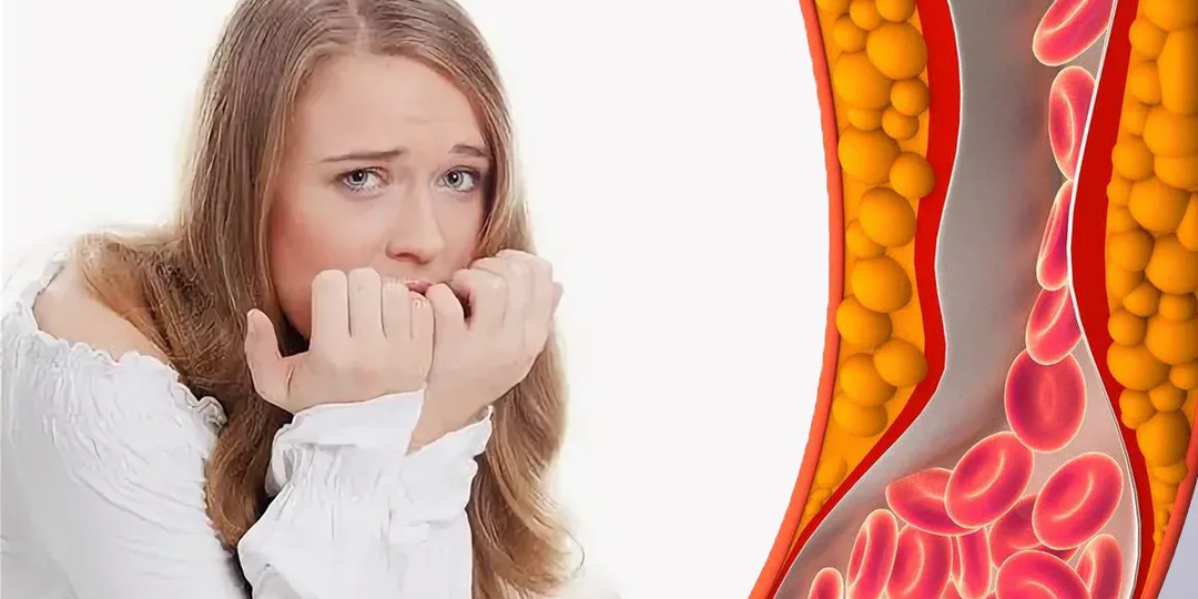 Дислипидемия: как высокий холестерин и триглицериды повреждают нервы