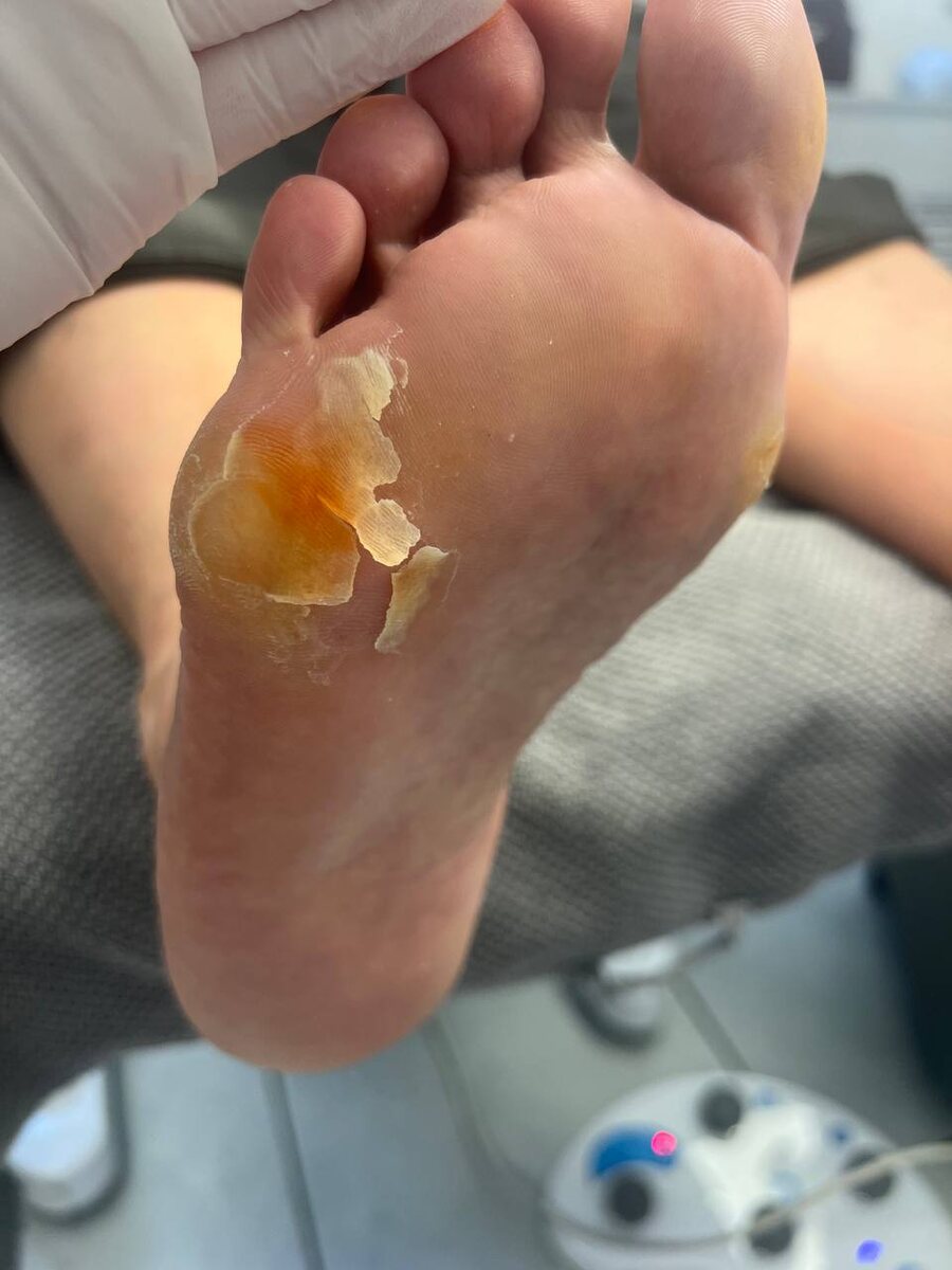 Клиент с лишним весом и постоянной работой на ногах