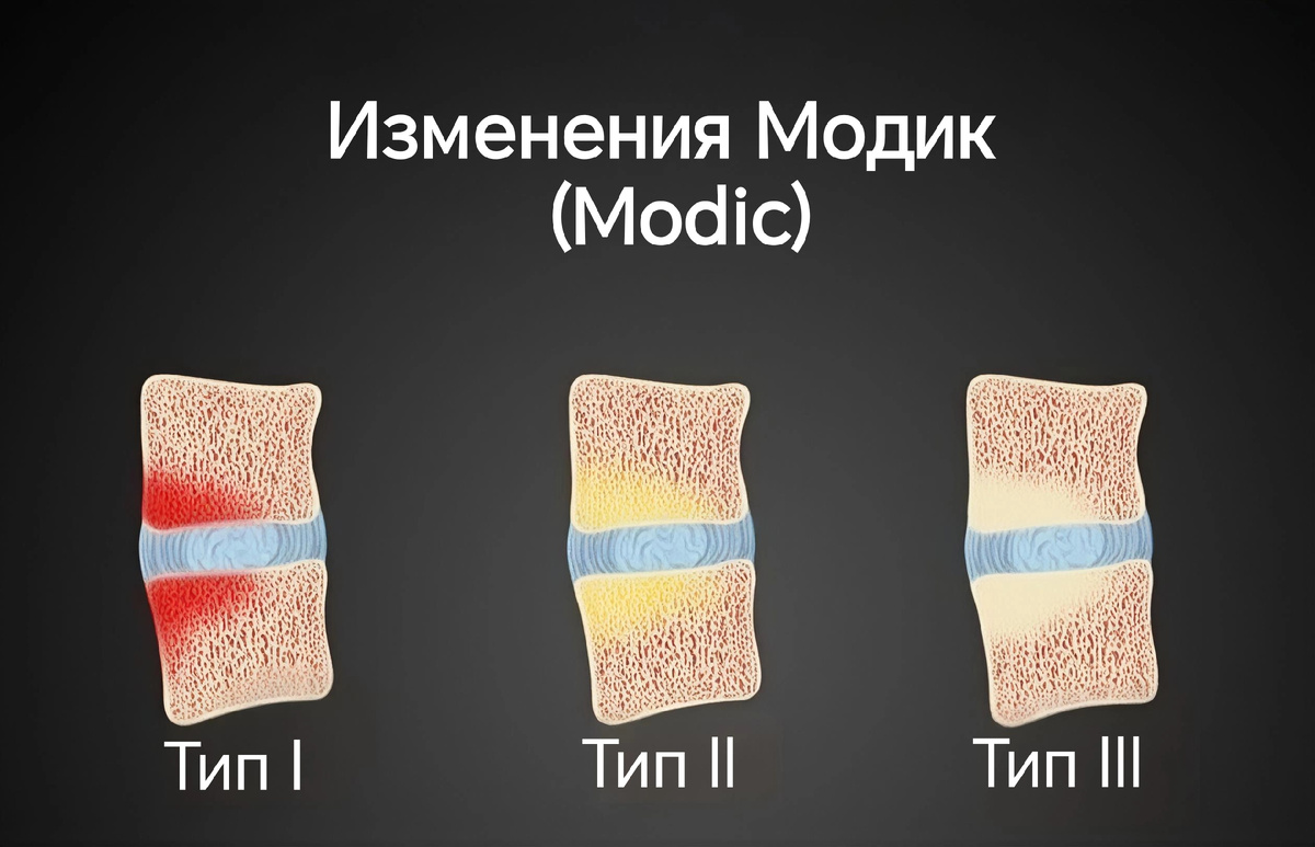 Иллюстрация типов изменений Модик