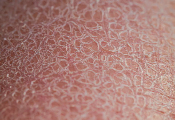 Голени как индикатор возраста: 5 изменений, которые вы зря списываете на усталость