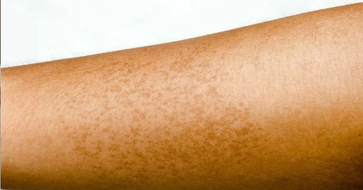 фото из открытого источника