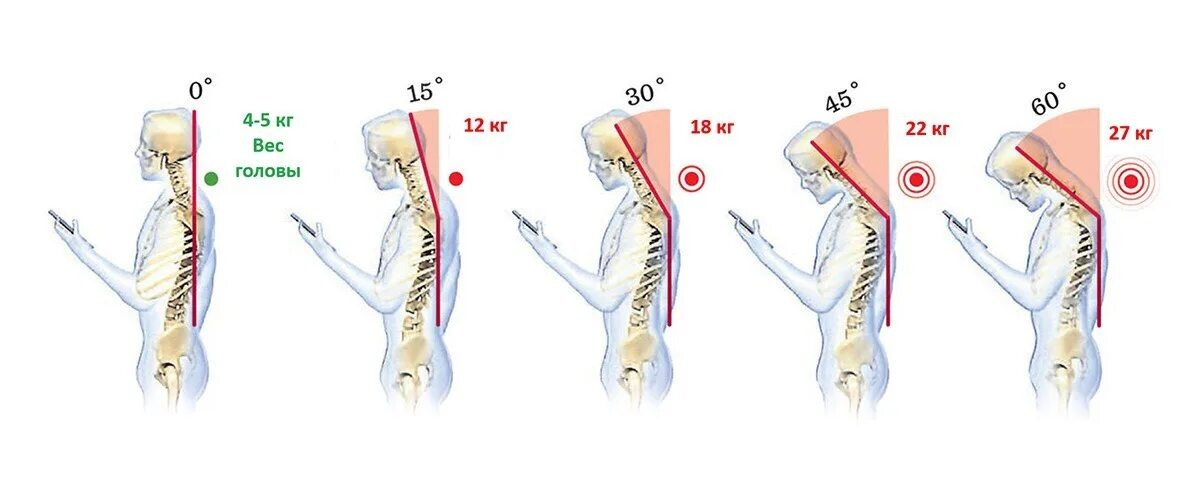 Нагрузка на шею при наклоне к гаджету