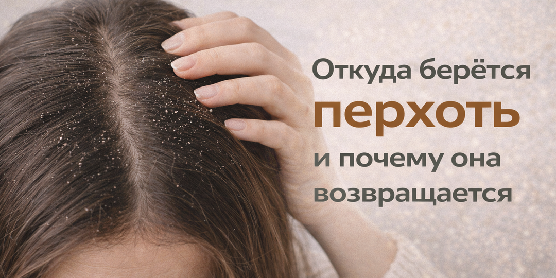 Откуда берётся перхоть и почему она возвращается