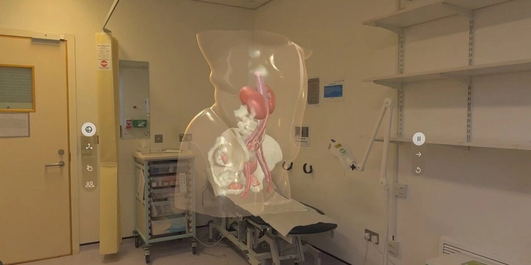 Британская больница использует Apple Vision Pro, чтобы помочь пациентам визуализировать ход операций