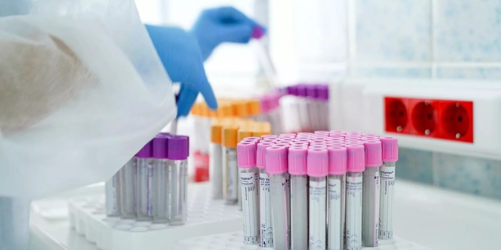 Учёные представили новый метод обнаружения ВИЧ