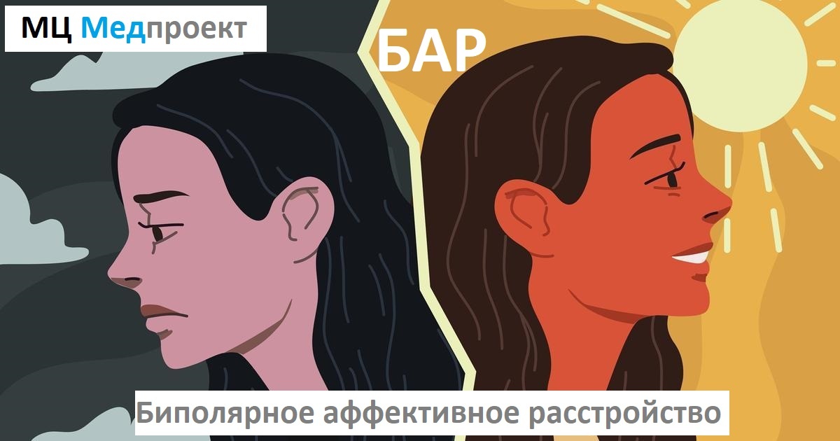 БАР (биполярное аффективное расстройство). МЦ Медпроект Генкиной 61