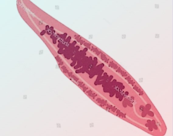 Описторхоз можно избежать: Полное руководство по профилактике