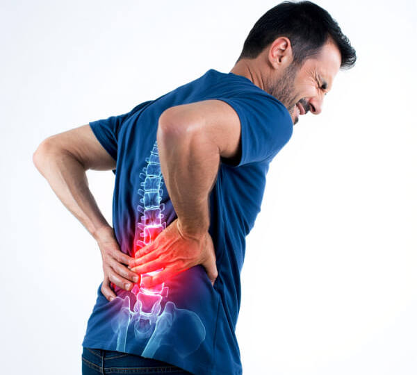 Фасеточный синдром позвоночника: почему «щелкает» и как убрать боль