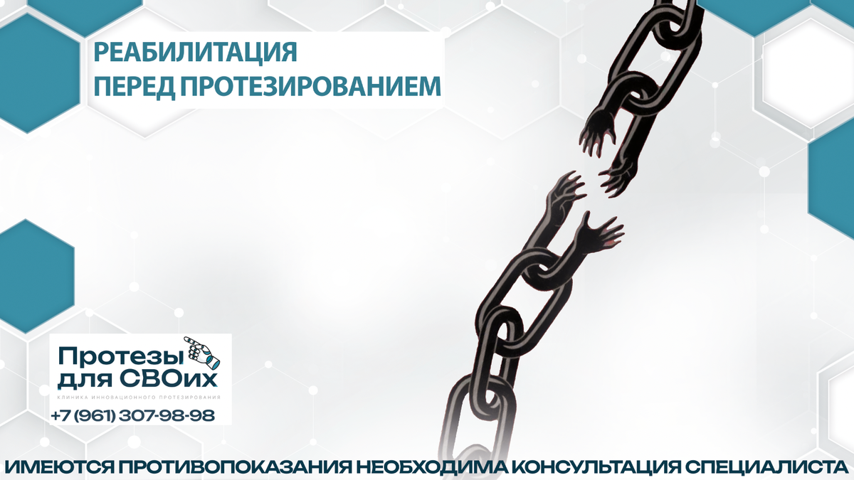 Ростов-на-Дону, ул. Таганрогская, 33, “Протезы для СВОих”