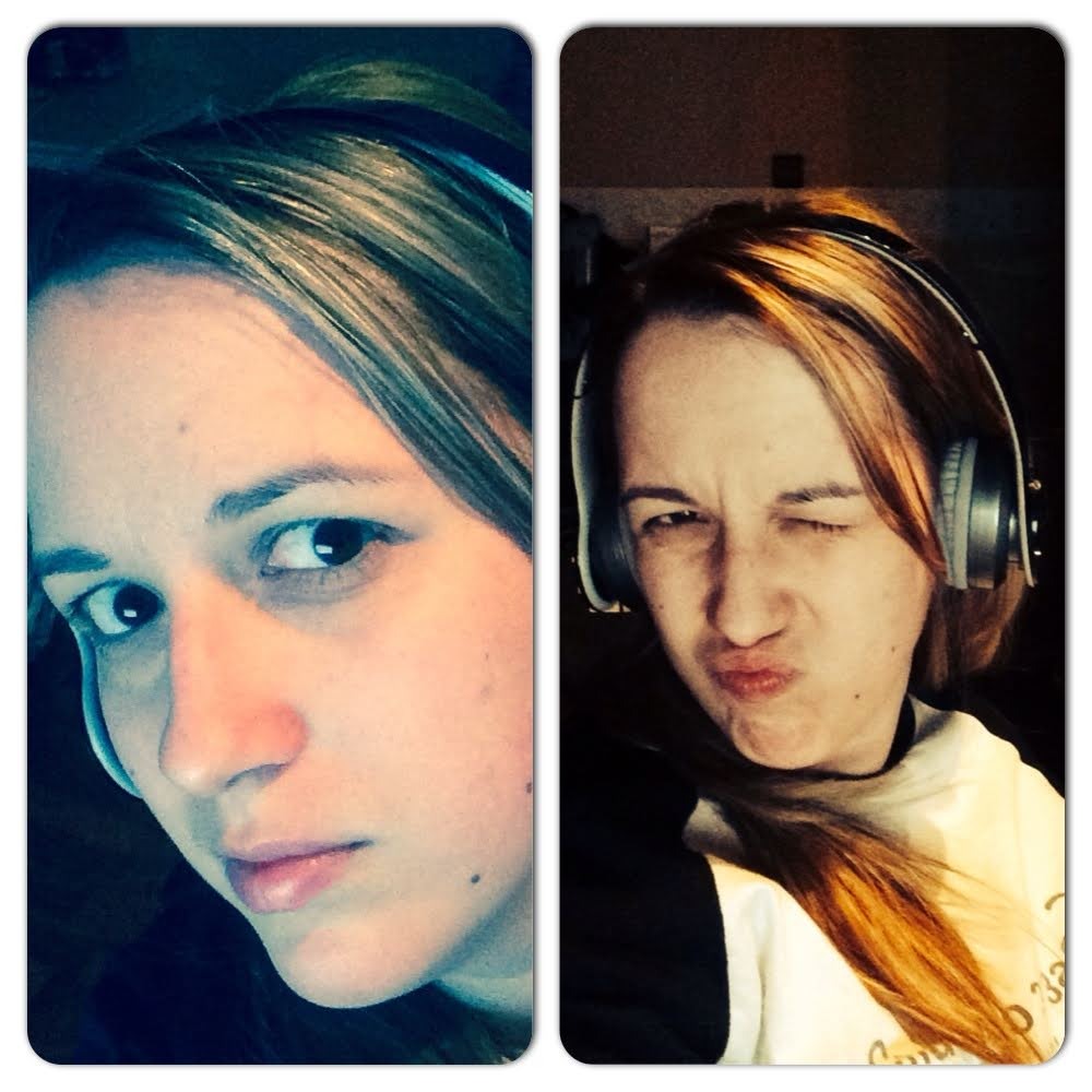 Когда прячешь синяки за смешной рожицей 