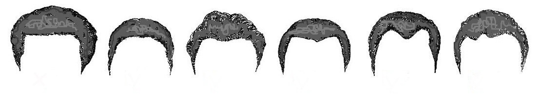 Изображение: типы роста волос