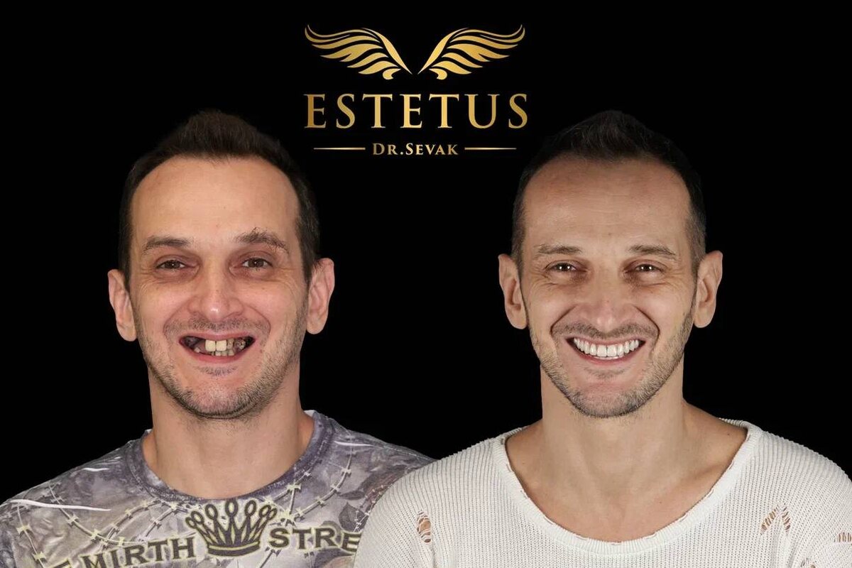  Даниил Владимирович, г. Москва, клиника доктора Севака Estetus