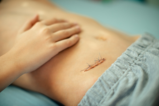 Острый аппендицит - что важно знать родителям об этой болезни