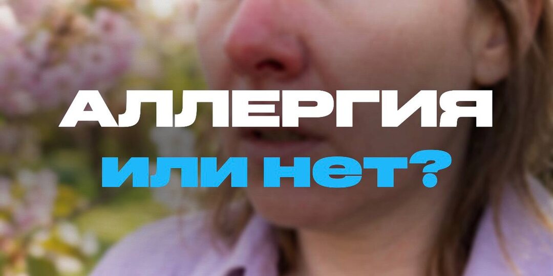 ЭТО ТОЧНО АЛЛЕРГИЯ