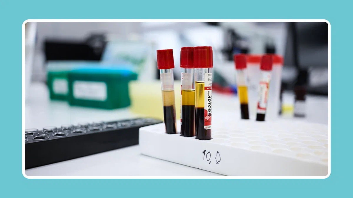 Базовые анализы по возрасту: почему в 25, 45 и 65 нельзя проходить один и тот же чек-ап