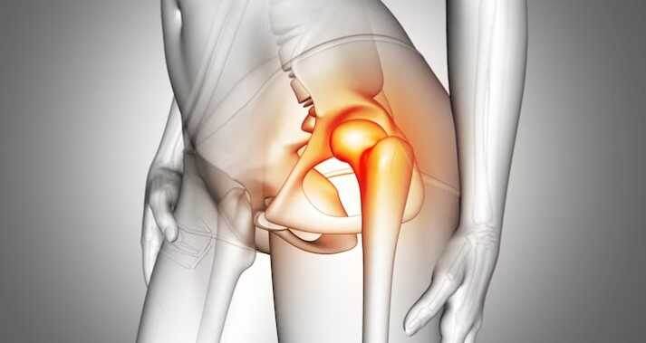 Хруст в коленях и тазобедренном? Вот 8 упражнений, которые снова включают суставы