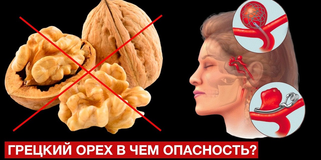 Врач: грецкий орех крайне противопоказан людям с... что творит грецкий орех?