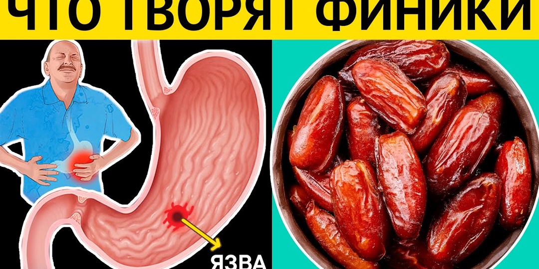 Врач: Даже один ФИНИК может вызвать НЕОБРАТИМЫЙ процесс в Вашем организме