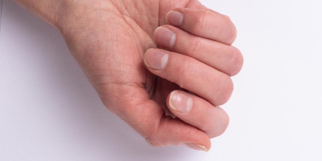 Как проявляются болезни ногтей