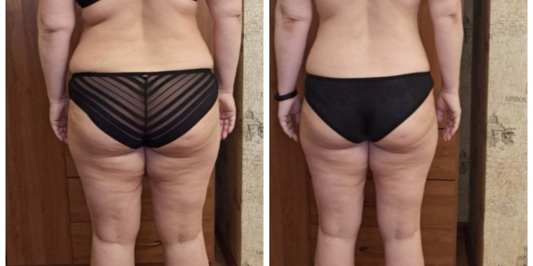 Как похудеть на 10 кг, когда не знаешь сытости?