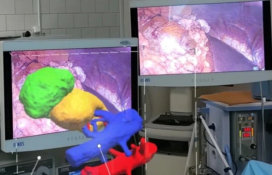    В Оренбуржье впервые провели урологическую операцию с использованием AR Оренбуржье