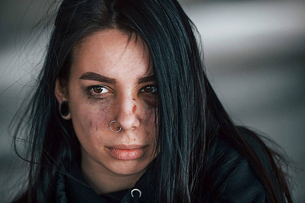 https://ru.pngtree.com/freebackground/indoor-portraiture-of-an-abused-young-woman-with-a-bruised-eye-in-an-abandoned-structure-photo_14926031.html