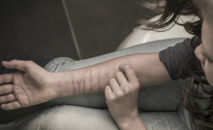 Зачем подростки режут себя: что стоит за порезами и как помочь своему ребёнку