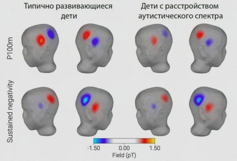    Иллюстрация к материалу: Ученые: особенности слуховой коры у детей с аутизмом могут влиять на речь