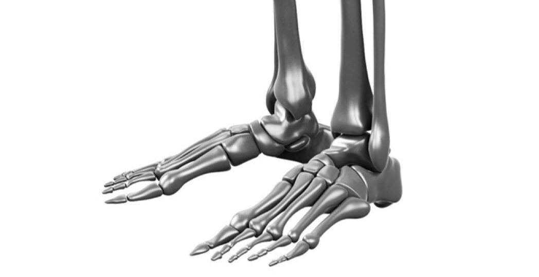 Лечение плоскостопия