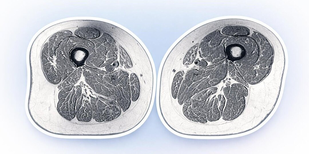 Сосиски, пицца и лимонад превращают наши мышцы в мраморные стейки