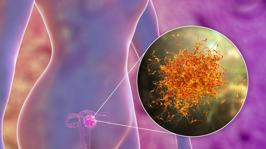    Фото: legion-media/KATERYNA KON/SCIENCE PHOTO LIBRARY