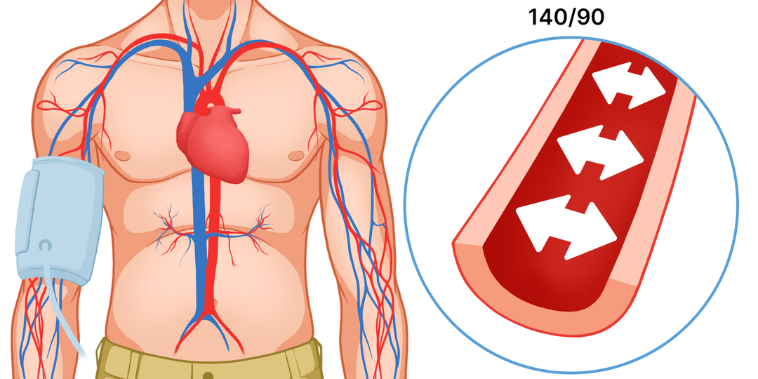 Симптомы Гипертонии: 5 Сигналов Повышенного Давления
